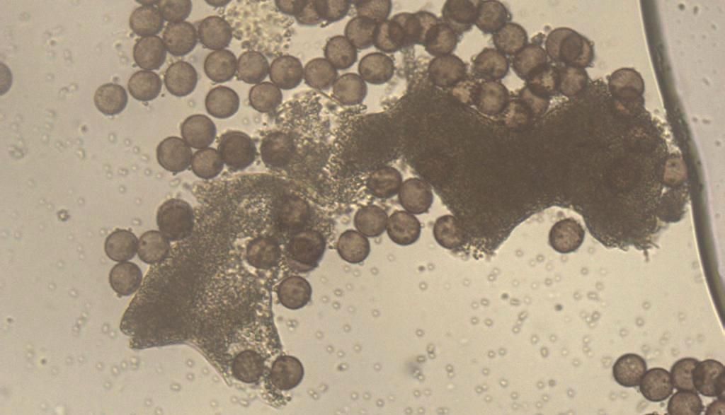 Physarum auriscalpium?